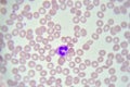 Neutrophil cell white blood cell in blood smear