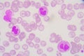 Neutrophil Royalty Free Stock Photo