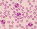 Neutrophil with red blood cells.