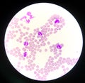 Neutrophil white blood cells on red blood cells background