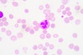 Neutrophils