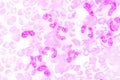 Neutrophils are a type of phagocyte and are normally found in th Royalty Free Stock Photo