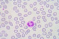 Neutrophils are a type of phagocyte and are normally found in th Royalty Free Stock Photo