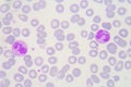 Neutrophils are a type of phagocyte and are normally found in th