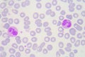 Neutrophils are a type of phagocyte and are normally found in th Royalty Free Stock Photo