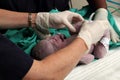 Doctor tagging new born baby