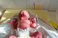 New born baby - girl with remainder of umbilical cord after successful childbirth. Real birthing and new born baby in a