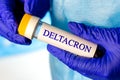 New infectious Deltacron variant of coronavirus desease Delta and Omicron sample in lab tube in the scientist hands