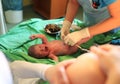 Newborn baby after birth in hospital Royalty Free Stock Photo