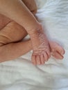 Newborn baby feet with flaky dry skin. Infant after born with very dry, wrinkled, cracked skin on foot