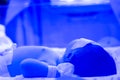 Newborn baby with hyperbilirubinemia / Neonatal jaundice under blue UV light for phototheraphy on infant warmer in neonatal