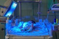 Newborn baby with hyperbilirubinemia under blue UV light for phototheraphy