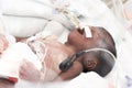 Newborn baby inside incubator Royalty Free Stock Photo