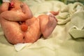 a newborn baby just after birth in the hospital Royalty Free Stock Photo