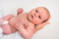 Newborn baby with skin rash. Allergic reaction after birth Royalty Free Stock Photo