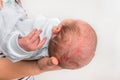 Newborn baby with skin rash. Allergic reaction after birth Royalty Free Stock Photo