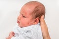 Newborn baby with skin rash. Allergic reaction after birth Royalty Free Stock Photo