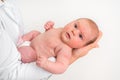 Newborn baby with skin rash. Allergic reaction after birth