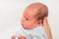 Newborn baby with skin rash. Allergic reaction after birth Royalty Free Stock Photo