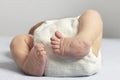 Newborn with bilateral club foot Royalty Free Stock Photo