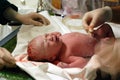 Newborn: cutting the umbilical cord