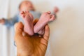 Newborn feet skinning held by mommy