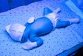 Newborn having a treatment for jaundice under ultraviolet lamp in home bed Royalty Free Stock Photo