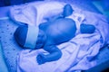Newborn having a treatment for jaundice under ultraviolet lamp in home bed Royalty Free Stock Photo
