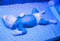 Newborn having a treatment for jaundice under ultraviolet lamp in home bed Royalty Free Stock Photo