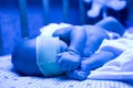 Newborn having a treatment for jaundice under ultraviolet lamp in home bed Royalty Free Stock Photo