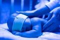 Newborn having a treatment for jaundice under ultraviolet lamp in home bed Royalty Free Stock Photo