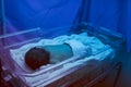 Newborn having a treatment for jaundice under ultraviolet light Royalty Free Stock Photo