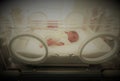 Newborn innocent baby sleeping in an incubator