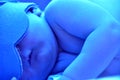 Newborn jaundice Royalty Free Stock Photo