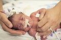 Newborn premature baby in the NICU intensive care Royalty Free Stock Photo