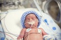 Newborn premature baby in the NICU intensive care Royalty Free Stock Photo