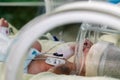 Newborn sick baby in an incubator