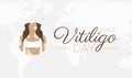 Nice Vitiligo Day Background Illustration for World Awareness Day Royalty Free Stock Photo