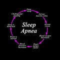 Stages in Development of Sleep Apnea