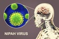 Nipah virus infection