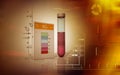 Nitrite test