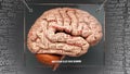 Non 24 hour sleep wake disorder in human brain Royalty Free Stock Photo