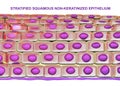 Non-keratinized stratified squamous epithelium