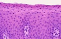 Non-keratinized stratified squamous epithelium Royalty Free Stock Photo