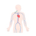 Central venous catheter in the jugular vein