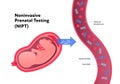 Noninvasive parental testing NIPT concept. Vector flat healthcare illustration. Genetic test. Baby in womb, blood vessel, dna