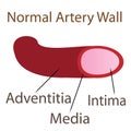 Normal artery wall illustration