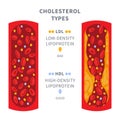 Normal and blocked artery with cholesterol clot infographics