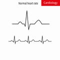 Normal ECG complex and normal sinus rhythm. Royalty Free Stock Photo