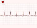 Normal electronic cardiogram. EPS 8